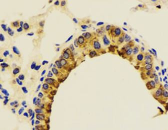 Anti-Transthyretin / Prealbumin