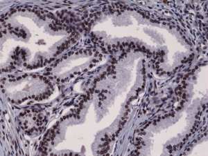 Anti-AR (N-terminal) (human), Rabbit Monoclonal (RM254)