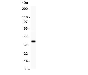 Anti-FGF-1