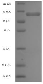 2-Oxoglutarate dehydrogenase, mitochondrial (OGDH), human, recombinant