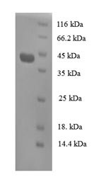 Regenerating islet-derived protein 3-alpha (REG3A), human, recombinant
