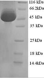Calreticulin (Calr), mouse, recombinant