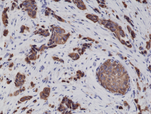 Anti-Cytokeratin-8 (human), Rabbit Monoclonal (RM266)