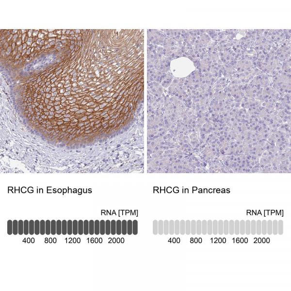 Anti-RHCG