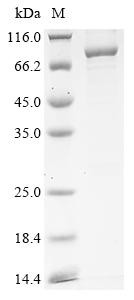 Nuclear pore complex protein Nup85 (NUP85), human, recombinant