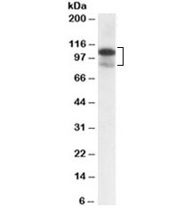 Anti-SATB1
