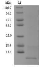Antitoxin MT2731 (MT2731), Mycobacterium tuberculosis, recombinant