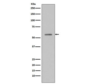 Anti-phospho-p53 / TP53 (Ser33), clone ACD-20