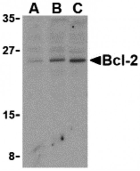 Anti-Bcl-2