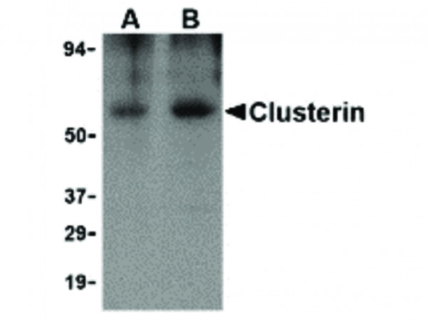 Anti-Clusterin