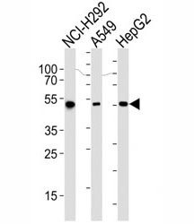 Anti-ALDH2, clone 138CT22.3.8