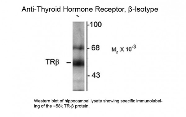 Anti-Thyroid Hormone Receptor beta, clone 2386