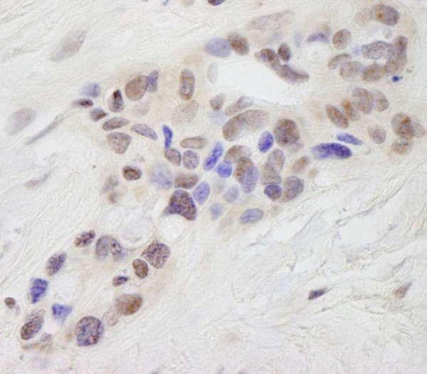 Anti-STAT6 (IHC)