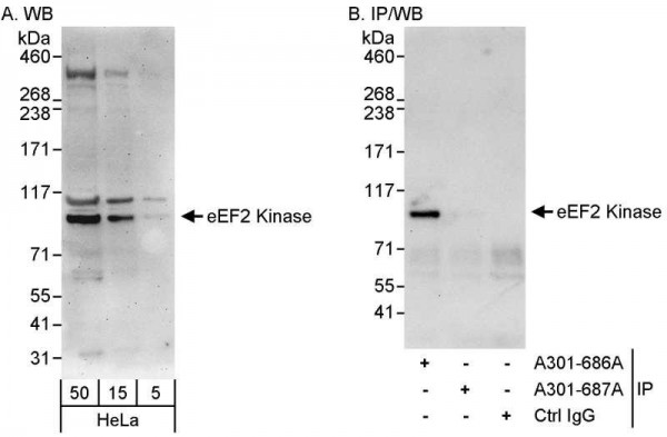 Anti-eEF2 Kinase