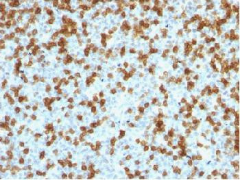 Anti-PDCD1 / PD1 / CD279 (Programmed Cell Death 1) (clone: PDCD1/1410R) (recombinant rabbit monoclon