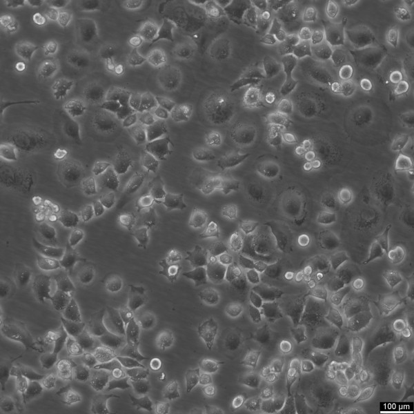 NCI-H23 Cells