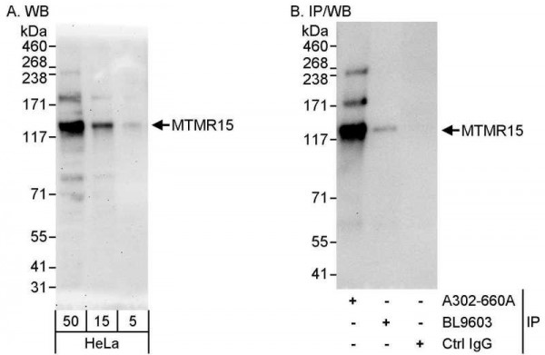 Anti-MTMR15