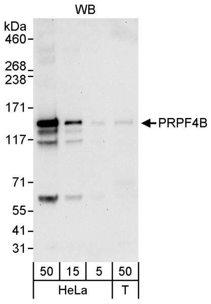 Anti-PRPF4B