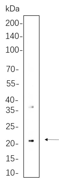 Anti-Recombinant CD90, clone 2B14