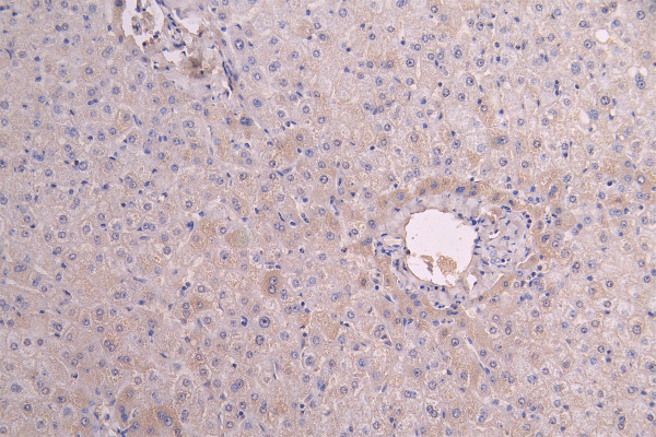 Anti-IL13RA1, recombinant clone 10E7