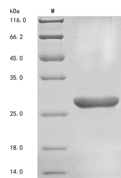 Basement membrane-specific heparan sulfate proteoglycan core protein (HSPG2), partial, human, recomb