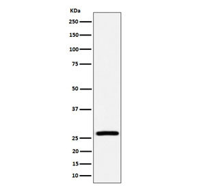 Anti-Adenylate kinase 2 / AK2, clone 29A42