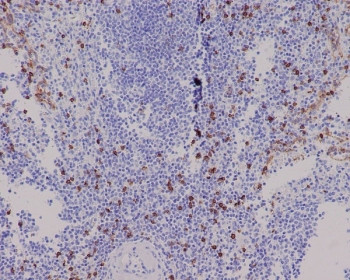 Anti-CD8A, clone BDG-3