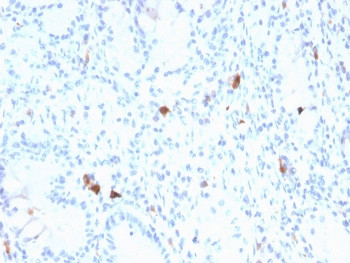 Anti-Gastrin, clone GAST/2634