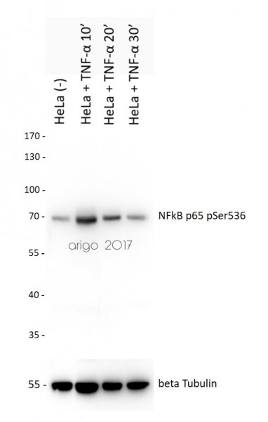 Anti-phospho-NFkB p65 (Ser536)