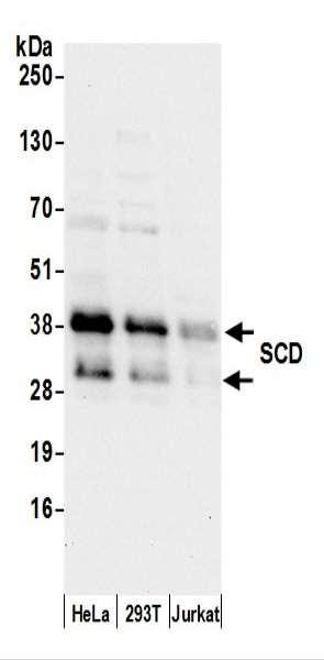 Anti-SCD/SCD1/Stearoyl-CoA Desaturase