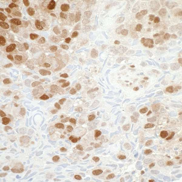 Anti-NAMPT/PBEF/Visfatin Recombinant Monoclonal