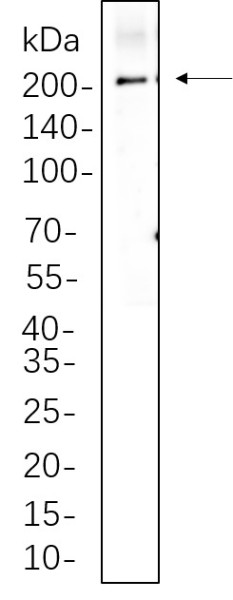 Anti-Recombinant LRP6, clone 11A1