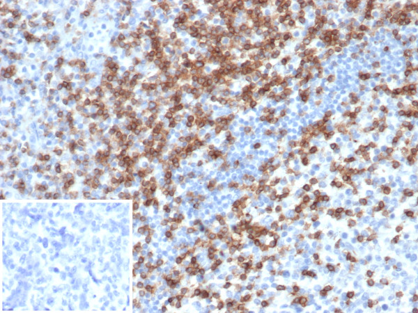 Anti-CD2 / Lymphocyte Function Antigen 2 (LFA-2), clone LFA2/7106