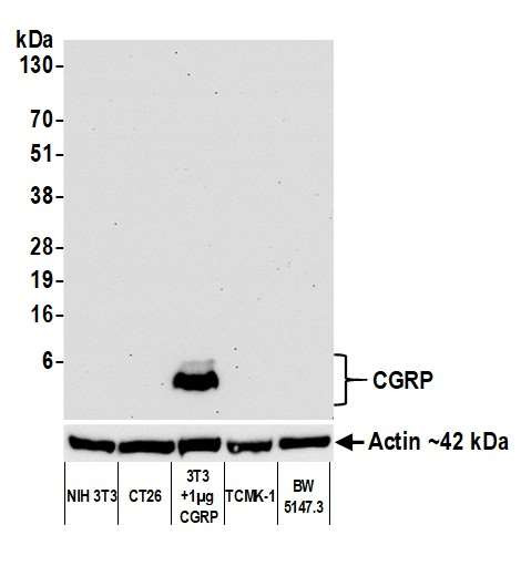 Anti-CGRP Recombinant Monoclonal
