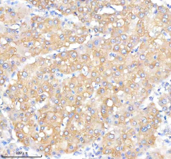 Anti-IQGAP2 / IQ motif containing GTPase activating protein 2, clone 29I69