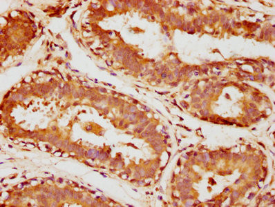 Anti-SULT1A3