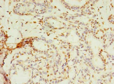 Anti-SMPDL3A