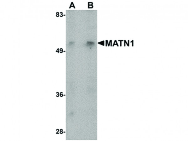 Anti-MATN1