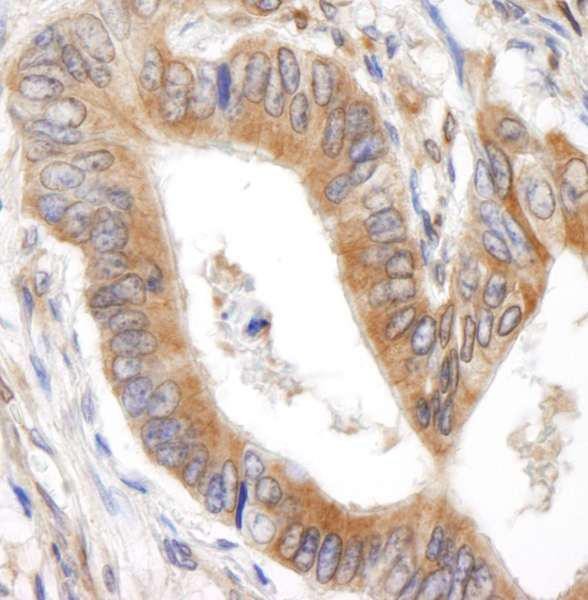 Anti-BID (IHC)