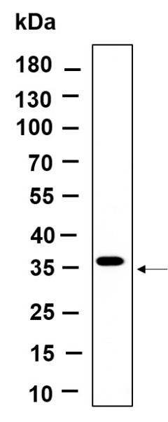 Anti-Recombinant BSND, clone 5B5