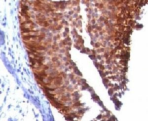 Anti-Cytokeratin 17 (KRT17), clone KRT17/778