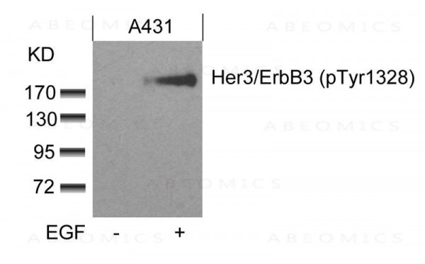 Anti-Her3/ErbB3 (phospho-Tyr1328)