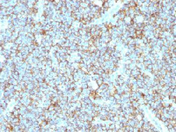 Anti-CD99 / MIC2 (Ewing s Sarcoma Marker) (clone: MIC2/1495R) (recombinant rabbit monoclonal)