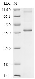STEAP family member 1 (Steap1), rat, recombinant