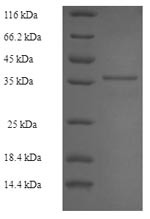 Latent membrane protein 1 (LMP1), partial, Epstein-Barr virus, recombinant