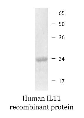 Human IL11 recombinant protein (Active)