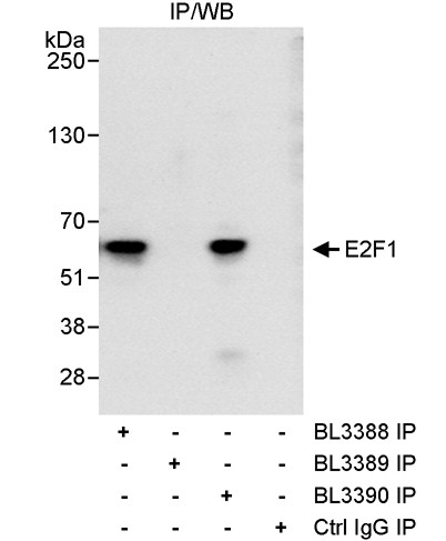 Anti-E2F1
