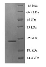 Lymphotoxin-beta (LTB), partial, Pan troglodytes, recombinant