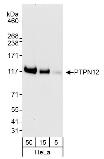 Anti-PTPN12