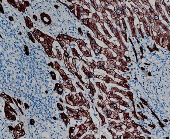 Anti-Cytokeratin 18, clone SQab18102